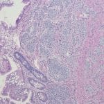 Microscopic view of tissue sample showing cellular structures and patterns, commonly used in medical imaging and pathology analysis