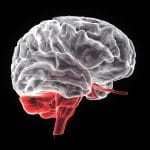 PET-CT brain scan showing metabolic activity patterns used in neurocognitive pathology assessment and diagnosis.