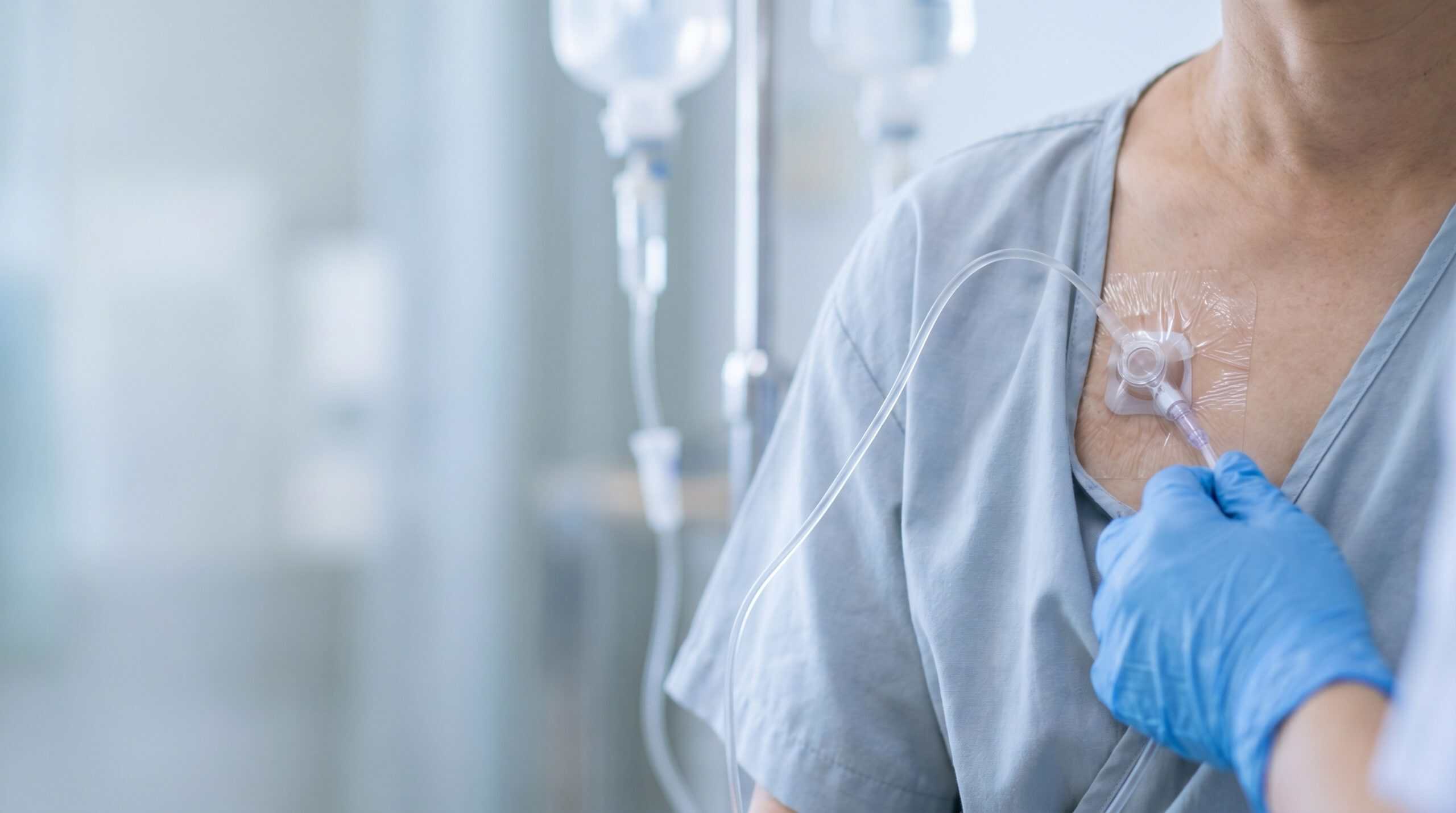 Nurse checking an accessed implanted chemo port on an adult patient's chest with IV tubing and transparent dressing